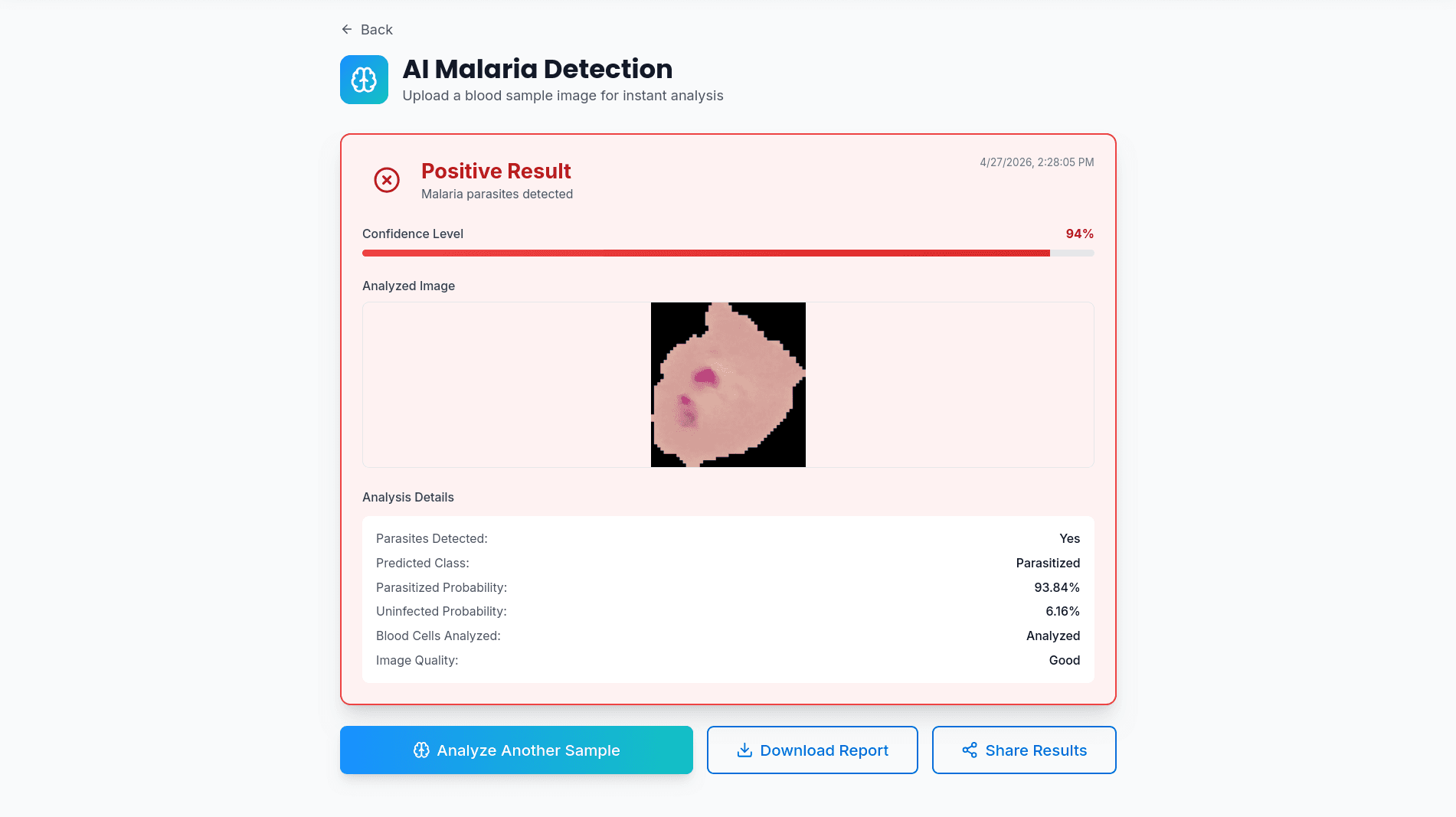 Malaria Detection System thumbnail 2
